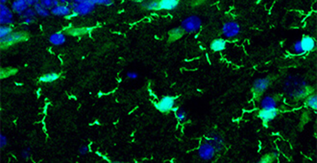 Microglia