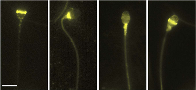 opsins in human sperm