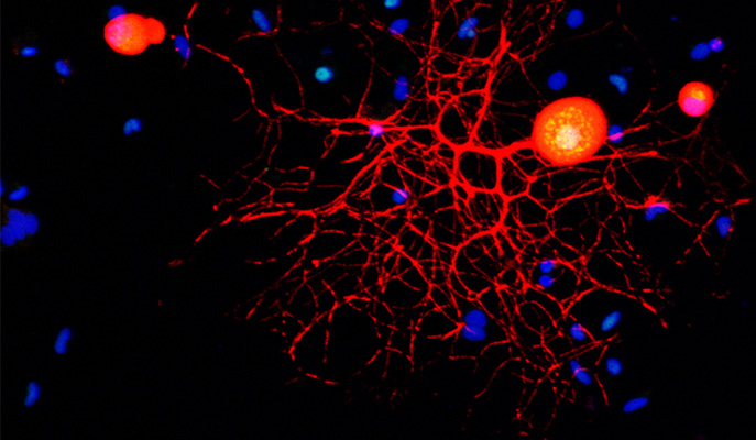 Peripheral Sensory Neuron