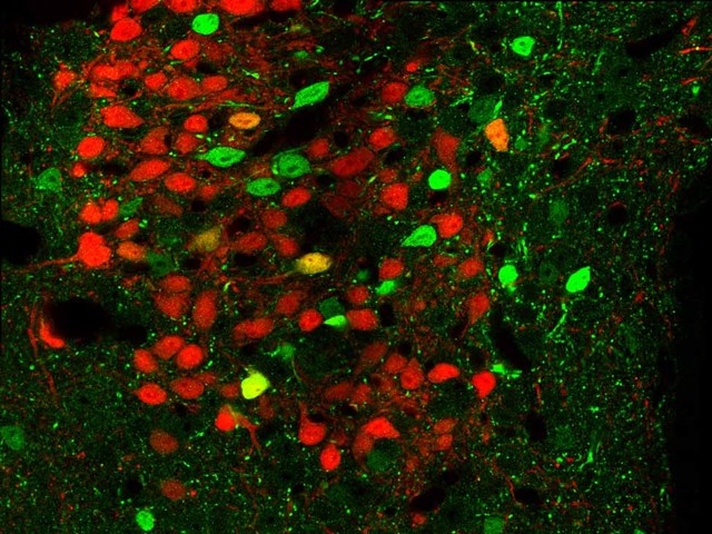 Brain tissue from genetically engineered mice