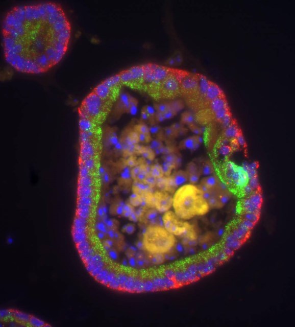 Circular Organoid