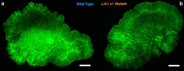 Organoids