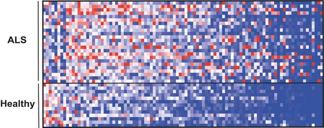 ALS and healthy patients