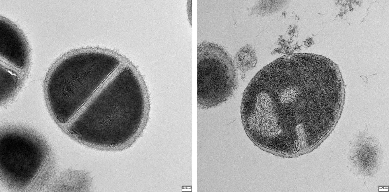 New Immune Mechanism Revealed In The Cellular Trash 2