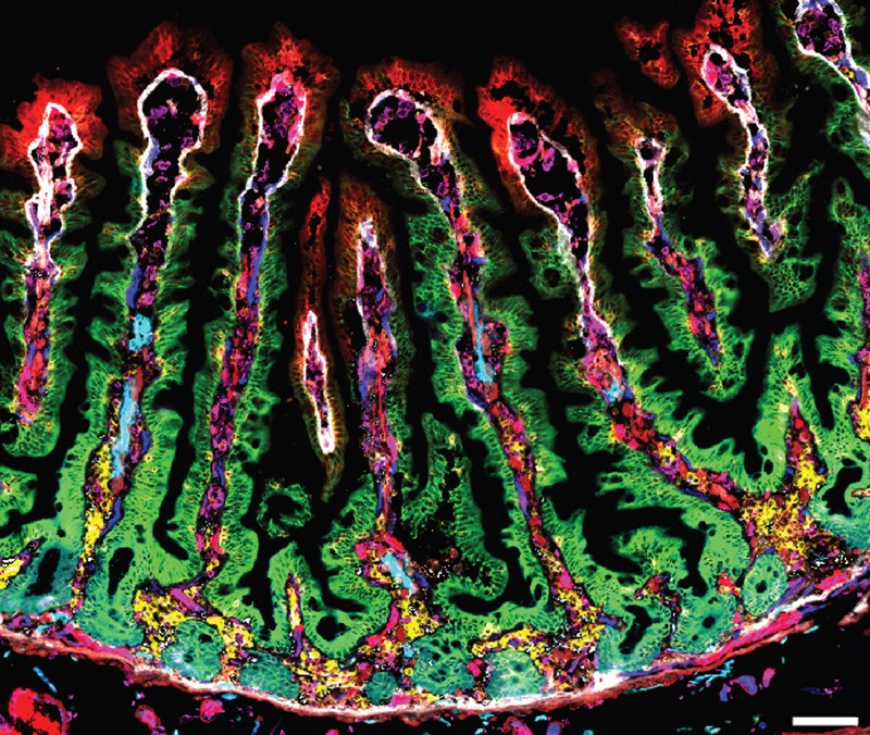 Mapping The Small Intestine