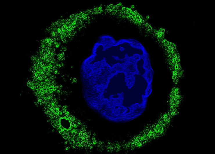 Antibodies Fight Cancer Too 5